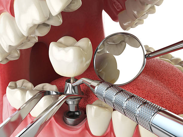 Best Cracked Tooth Emergency Dentist  in Memphis, MO